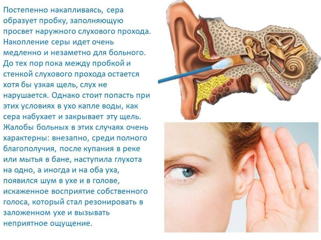 Что делать, если наушники давят на уши: как избавиться от проблемы