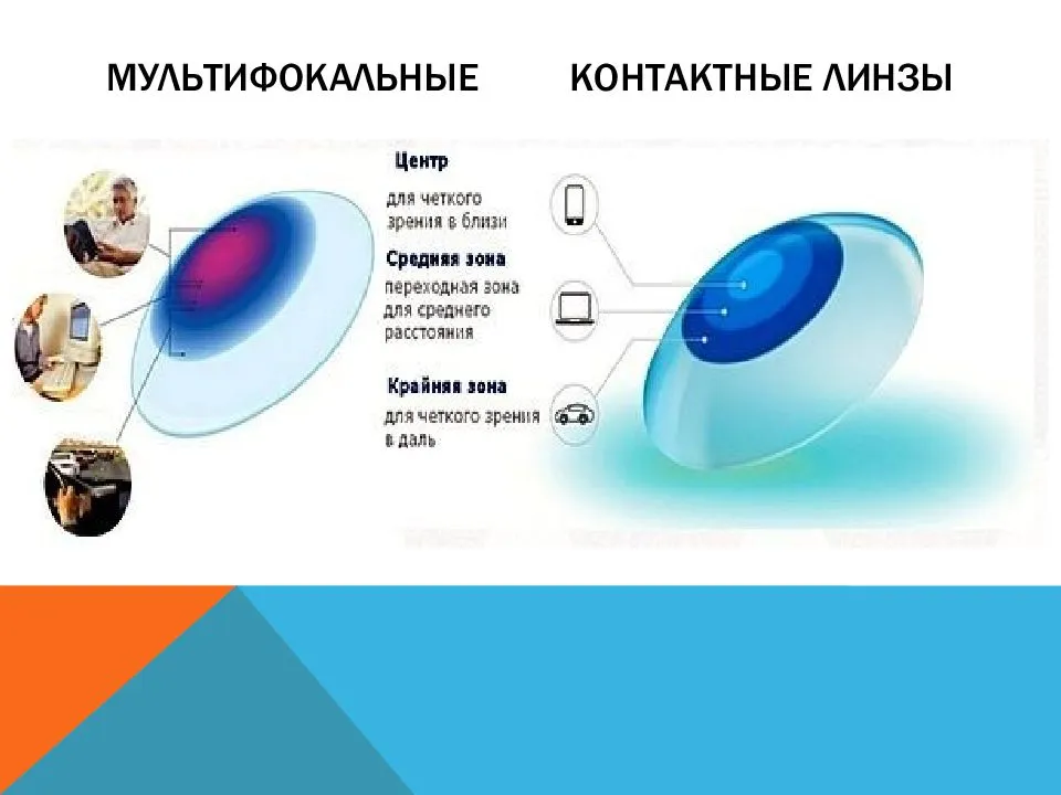 Виды контактных линз